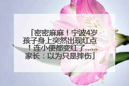 密密麻麻！宁波4岁孩子身上突然出现红点！连小便都变红了……家长：以为只是摔伤